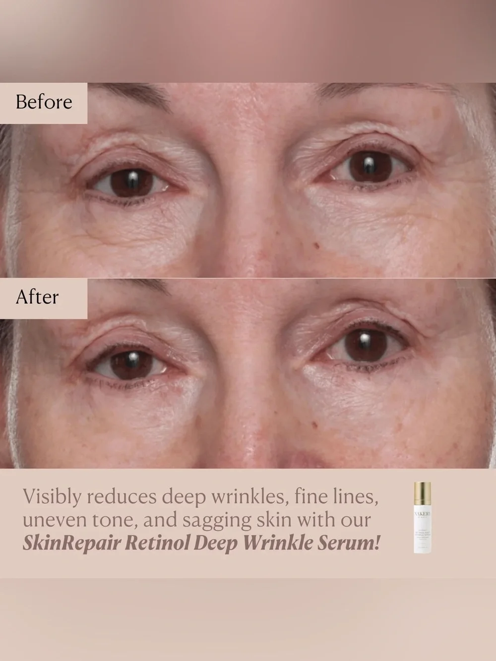 Nakery Beauty SkinRepair Retinol Deep Wrinkle Serum- firming, lifting, smoothing